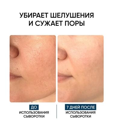 COSMEYA Acidly polishing piling of a face serum - Buy Online on GoSupps.com