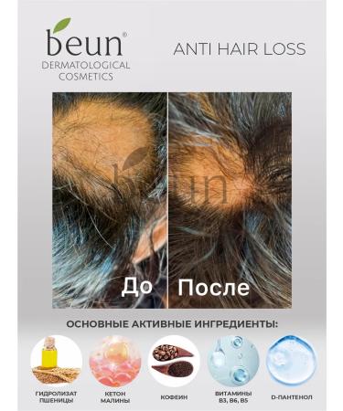Beun Anti-hair loss shampoo - Buy Online on GoSupps.com
