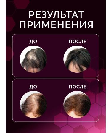 Highland Premium Hair and eyebrows growth serum 2% - Buy Online on GoSupps.com