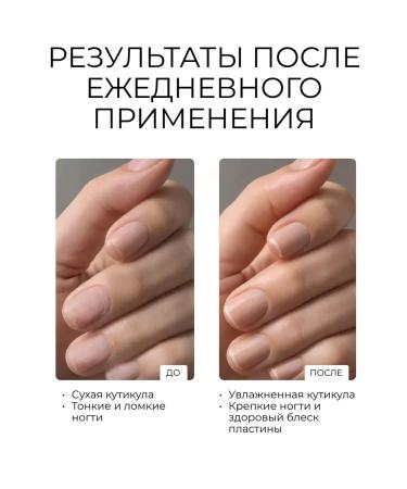 la'mour Oil for cuticle for deep nutrition and moisturizes - Buy Online on GoSupps.com