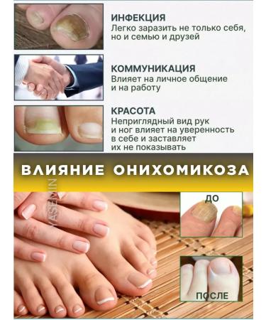yasemin Feet remedies from nail fungus - Buy Online on GoSupps.com