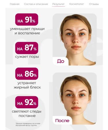 ME:OK Facial serum with niacinamide from acne and acne - Buy Online on GoSupps.com