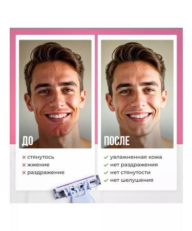 Elastik Lotion Cream after depilation perfect recovery 200 ml - Buy Online on GoSupps.com