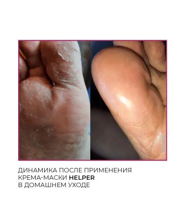 Rosilak Cream mask for the skin of the legs of nails and cutouts - Buy Online on GoSupps.com