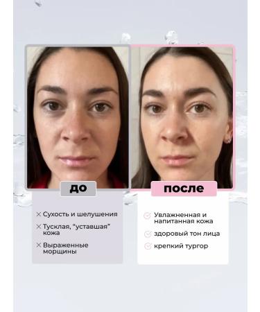 cosmetics Botox facial serum - Buy Online on GoSupps.com