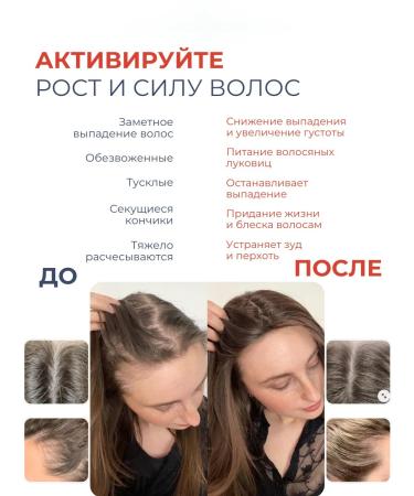 La-oil Serum activator for hair growth 100 ml - Buy Online on GoSupps.com