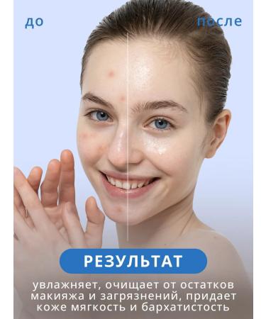 Babaria A set of hyaluronic acid washing gel and cream - Buy Online on GoSupps.com