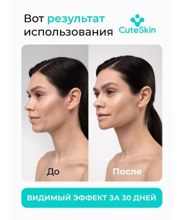 CuteSkin Facial face mask for a chin pulling lifting - Buy Online on GoSupps.com