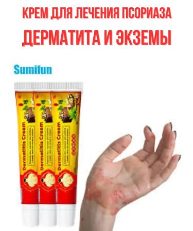 Narmina Body cream from eczema dermatitis