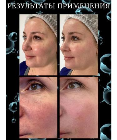 France Bloom Mask Face Face Witch Set of two -component masks - Buy Online on GoSupps.com