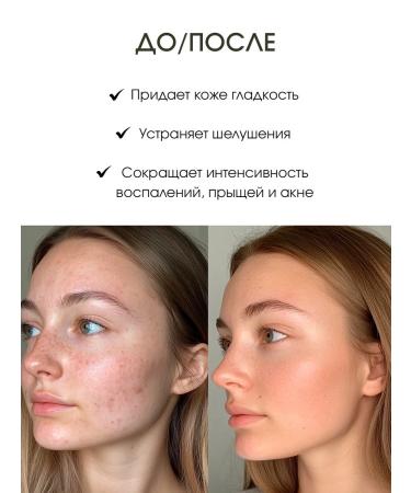 Elizavecca Enzyme powder with green tea for the face and body - Buy Online on GoSupps.com