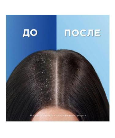 Hair shampoo Head & Shoulders Mentol 2V1 400ml - Buy Online on GoSupps.com