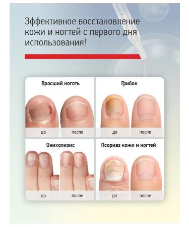 IQ BEAUTY Collagen whey for nail recovery - Buy Online on GoSupps.com