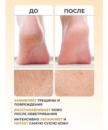 AVITSENNA Cream-Vosk from cracks with urea and bee wax - Buy Online on GoSupps.com