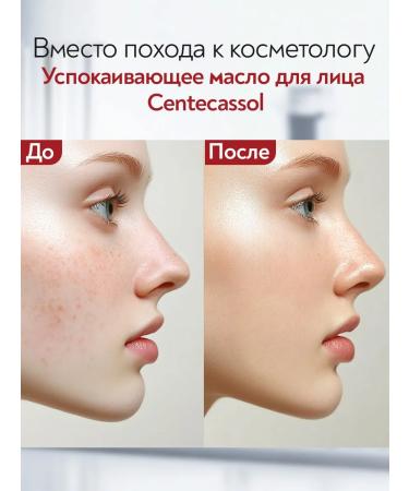 Centecassol Cleaning calming oil for washing the face 150ml - Buy Online on GoSupps.com
