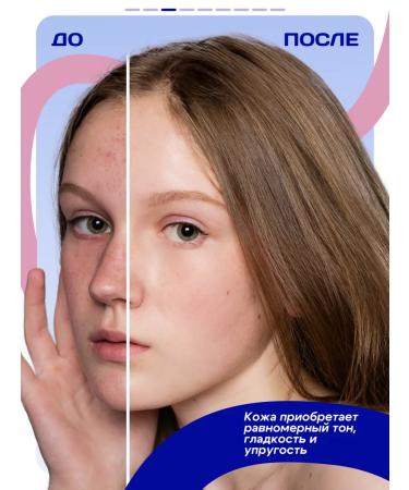 Noxo Peeling face roll - Buy Online on GoSupps.com