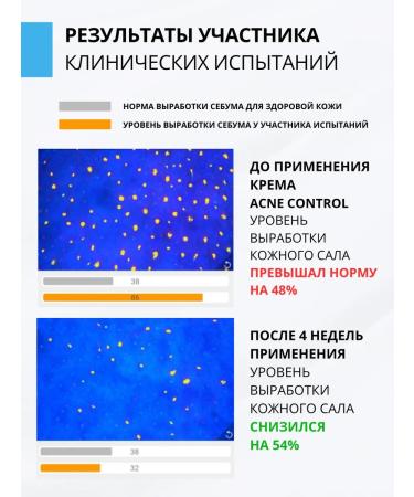 DR MARCUS HEILER Acne cream and acne on the face for teenagers - Buy Online on GoSupps.com