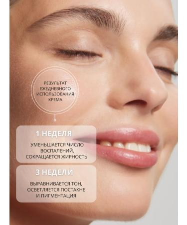 DR MARCUS HEILER Acne cream and acne on the face for teenagers - Buy Online on GoSupps.com