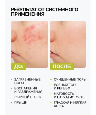 Y&B Gel for washing the face washing a moisturizing cleansing - Buy Online on GoSupps.com