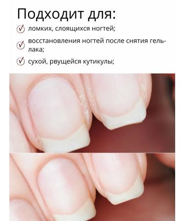 MILV Nail oil and cuticle strengthening with pistachio shimmer - Buy Online on GoSupps.com