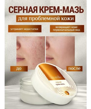 Luxurelle Sulfuric ointment from acne scabies losing