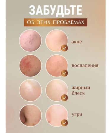 Luxurelle Sulfuric ointment from acne scabies losing - Buy Online on GoSupps.com