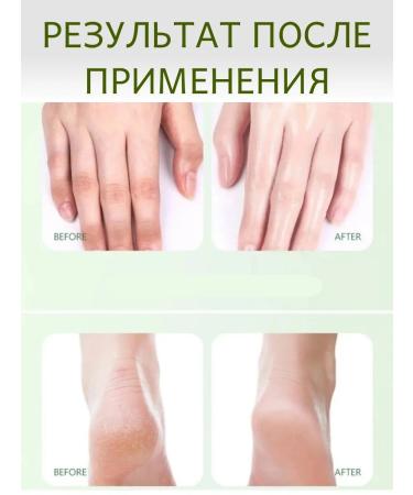 EKit Cream for dry skin from cracks and peeling - Buy Online on GoSupps.com