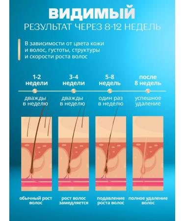 KKM Photoeper Laser IPL - Buy Online on GoSupps.com