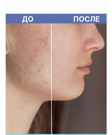 ZenWay Facial serum from acne perfect skin - Buy Online on GoSupps.com