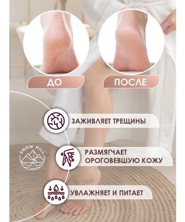 Snow Hill Light pedicure-yield Gift set 5 pieces - Buy Online on GoSupps.com