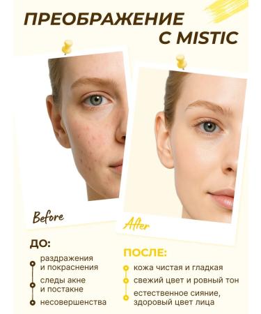 MYSTIC Foam for washing the regenerative for the face of Korea 180ml - Buy Online on GoSupps.com