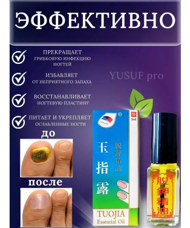 Sadoerr Nail fungus remedy