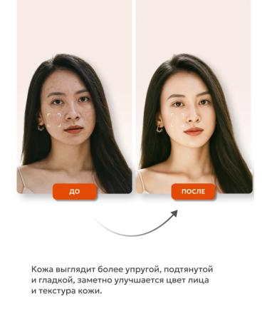 Rojukiss Facial serum from acne and black dots (toner) - Buy Online on GoSupps.com