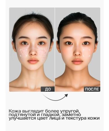 Rojukiss Facial mask for dry skin of intensive action 5x - Buy Online on GoSupps.com