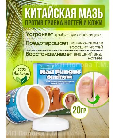 TOPSHOP Chinese remedy for nail fungus 20 g