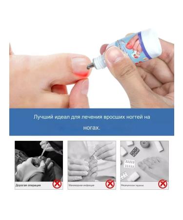 GUGU Failure fungus treatment agent - Buy Online on GoSupps.com