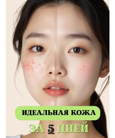 Dr Jart+ Point for the face from acne acne dr jart serum - Buy Online on GoSupps.com