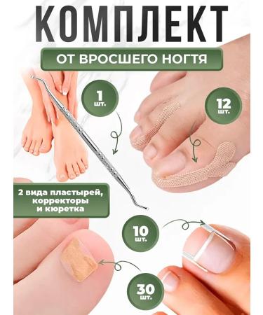 Fusi Pedicure chabers to correct the ingrown nail