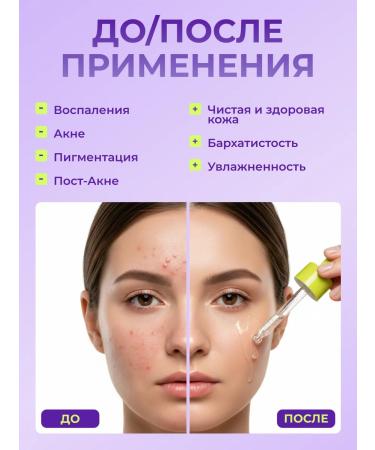 WISTERY Moisturizing serum for the face with niacinamide 30 ml - Buy Online on GoSupps.com