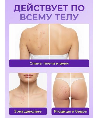 WISTERY Moisturizing serum for the face with niacinamide 30 ml - Buy Online on GoSupps.com