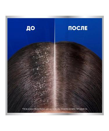 Head & Shoulders Pro-Expert 7 shampoo against itching Mint and menthol 600ml - Buy Online on GoSupps.com