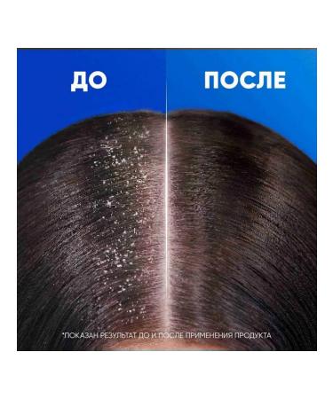 Head & Shoulders Fandword shampoo main care 400ml - Buy Online on GoSupps.com