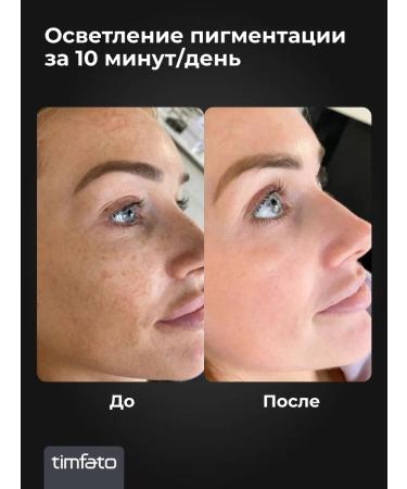 TIMFATO LED LED mask for face rejuvenation - Buy Online on GoSupps.com