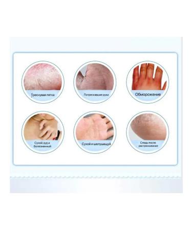 FUZHUN Cream for dry skin and skin cracks 2pcs - Buy Online on GoSupps.com