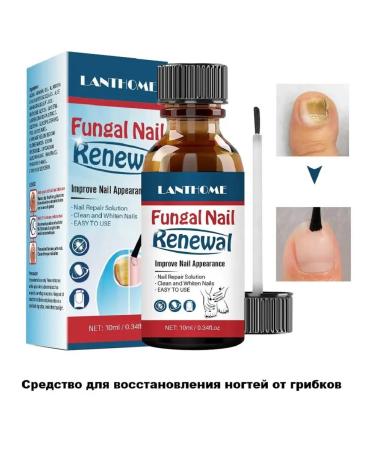 Antifungal agent for therapeutic restoration of nails