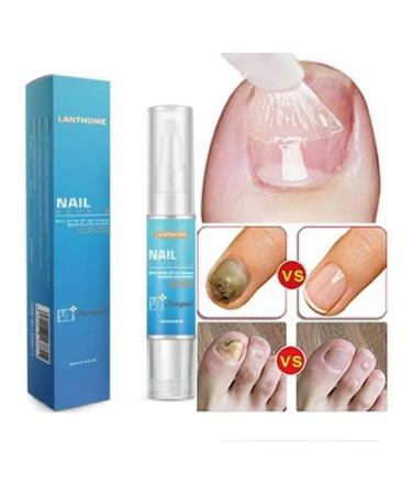 SUPER-HIT Nail fungus remedy - Buy Online on GoSupps.com