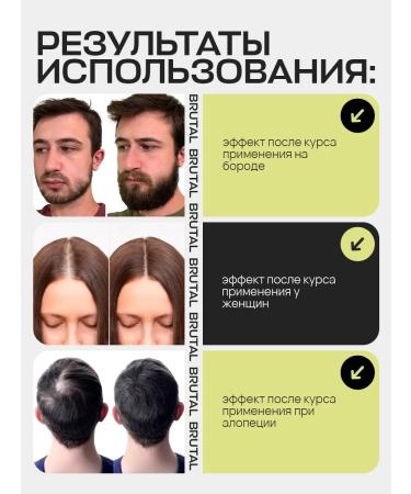 VIS MEDICUS Hair growth serum - Buy Online on GoSupps.com
