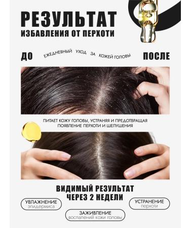 NO'S Burdock oil for hair 30 ml - Buy Online on GoSupps.com