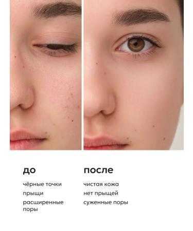 Likato professional Face mask from acne and black dots cleansing 50 ml - Buy Online on GoSupps.com