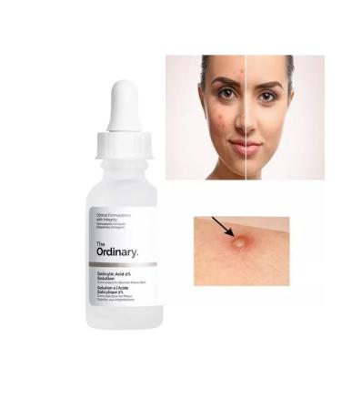 The ordinary Salicylic pimples 2% - Buy Online on GoSupps.com